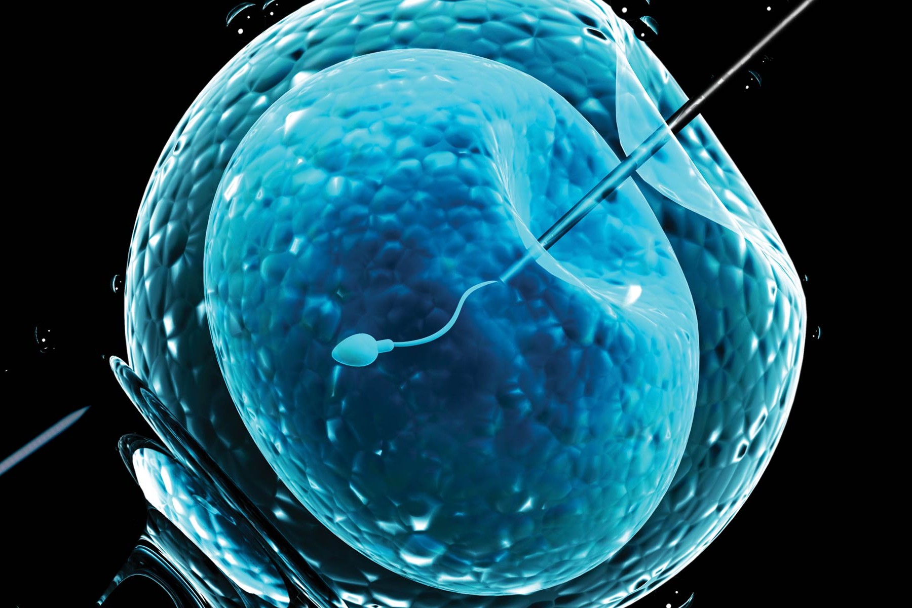 IVF